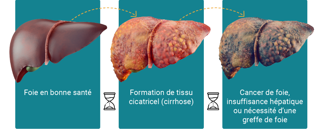 Infographic_Liver_Health_F_v2
